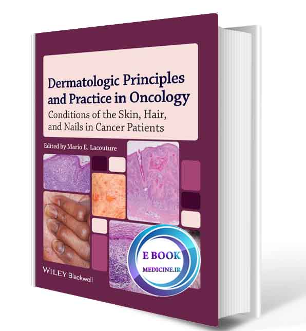 دانلود کتاب Dermatologic Principles and Practice in Oncology: Conditions of the Skin, Hair, and Nails in Cancer Patients(ORIGINAL PDF)